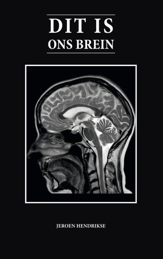 Dit is ons brein - cover