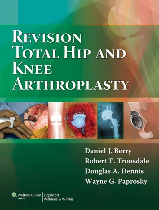 Revision Total Hip and Knee Arthroplasty - cover