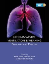 Non-invasive Ventilation and Weaning