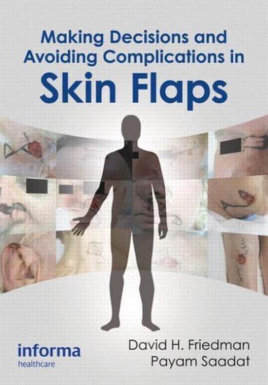 Making Decisions And Avoiding Complications In Skin Flaps - cover