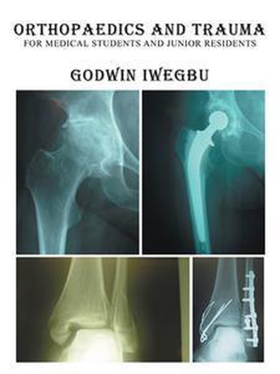 Orthopaedics and Trauma for Medical Students and Junior Resi ... - cover