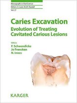 Caries Excavation