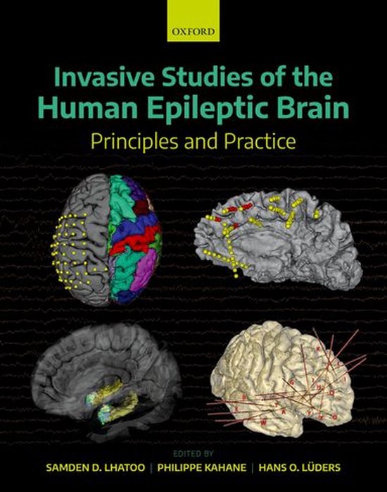 Invasive Studies of the Human Epileptic Brain - cover