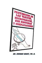 Prevencion de Las Varices, Microvarices, Sus Sintomas Y Complicaciones