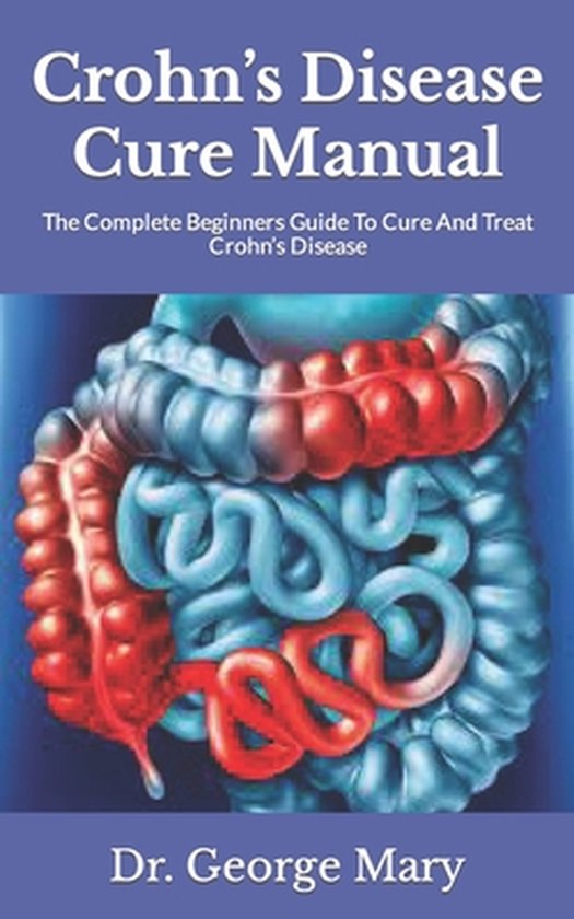 Crohn's Disease Cure Manual, Dr Mary 9798498520834 Boeken