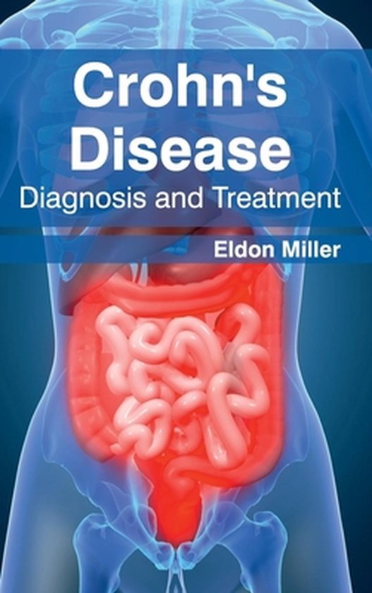 Crohn's Disease Diagnosis and Treatment 9781632420978 Boeken