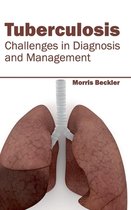 Tuberculosis: Challenges in Diagnosis and Management