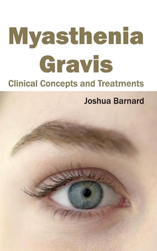 Myasthenia Gravis Clinical Concepts And Treatments 9781632422828 Boeken 1823