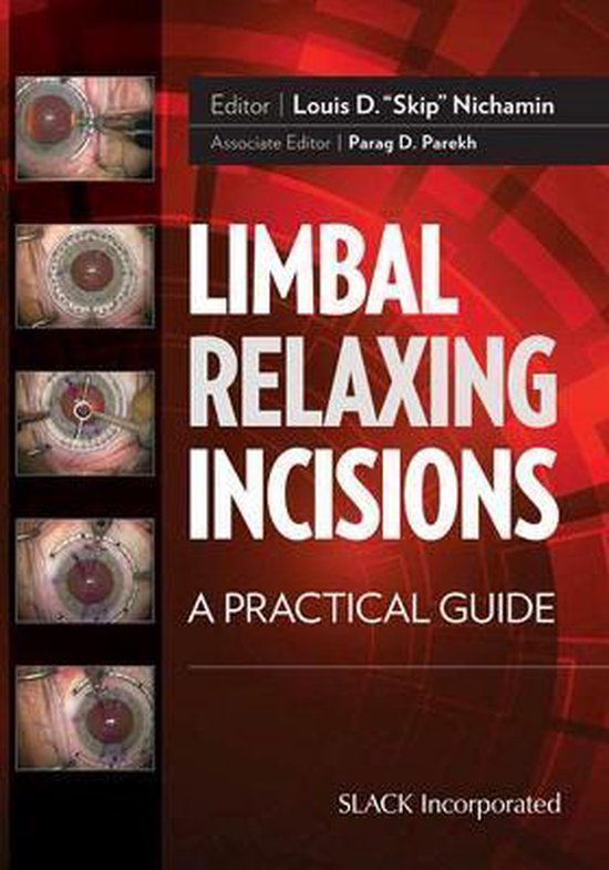 Limbal Relaxing Incisions | 9781617118388 | Louis D Nichamin | Boeken ...