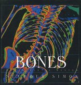 Bones