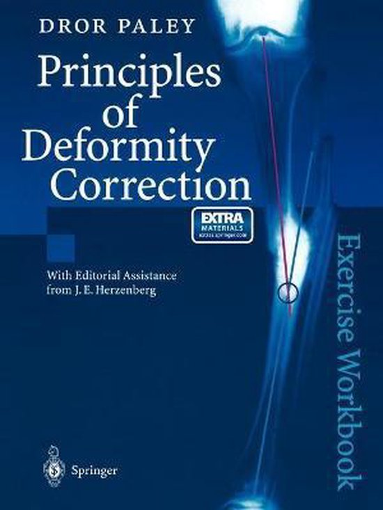 Principles Of Deformity Correction - cover