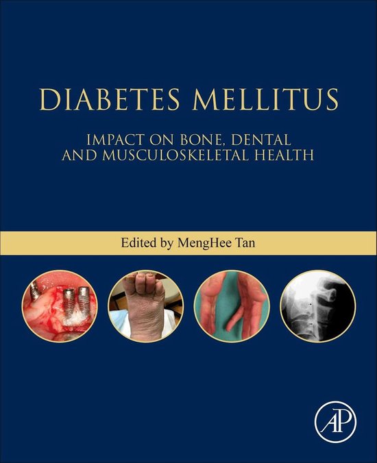 Bones, Joints, and Hormones series - Diabetes Mellitus - cover