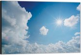 Dibond –Blauwe Lucht met Wolken en Zon– 150x100 Foto op Aluminium (Wanddecoratie van metaal)