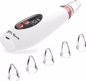Blackhead remover Vacuum - mee eters verwijderen – meeters remover - Elektrische Vacuüm Mee-eter Verwijderaar - Puisten Verzorging - Pore Cleaner - Gezichtsverzorging – Pore Suction Cleaner -