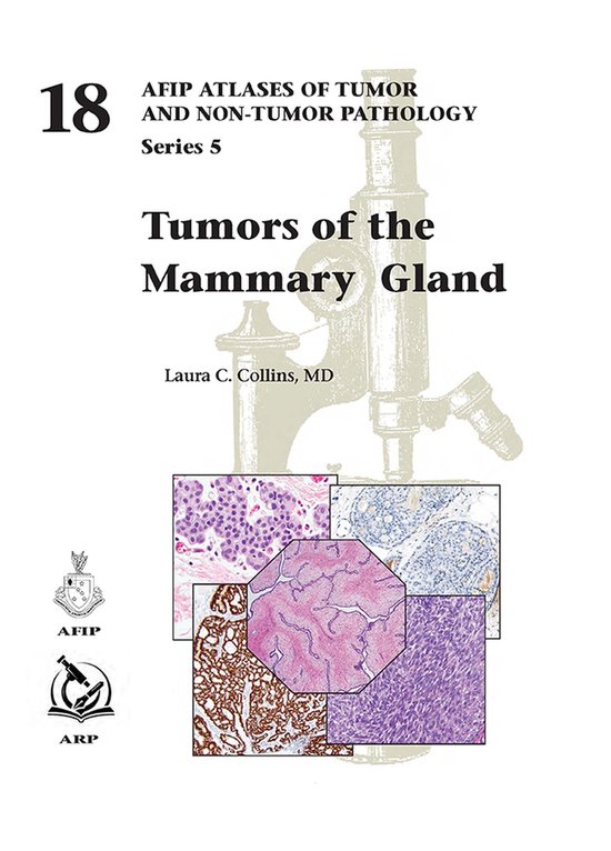 Titelpagina van 'AFIP Atlases of Tumor and Non-Tumor Pathology, Series 5: Tumors of the Mammary Gland', met afbeelding van een microscoop en pathologische weefselcoupes.