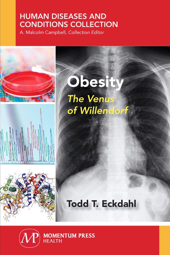 Human Diseases and Conditions Collection- Obesity