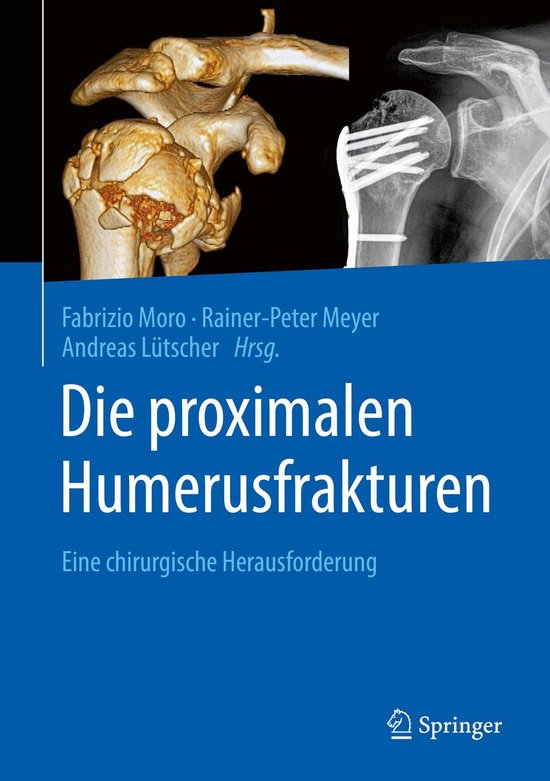 Die proximalen Humerusfrakturen - cover