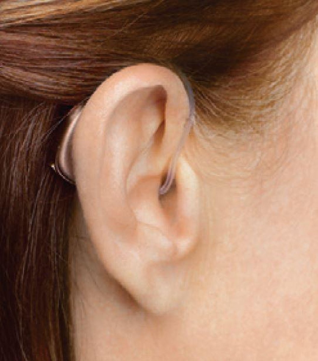 Widex EVOKE 440 Passion*