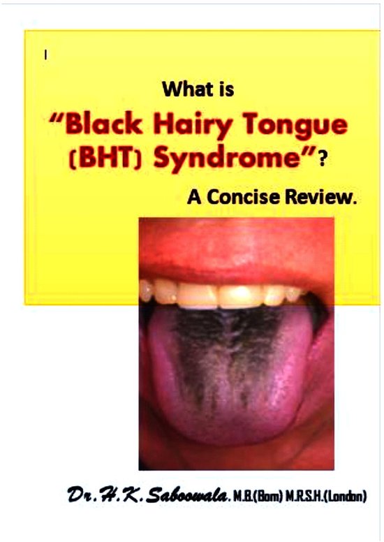 What is “Black Hairy Tongue (BHT) Syndrome”? A Concise Review. (ebook