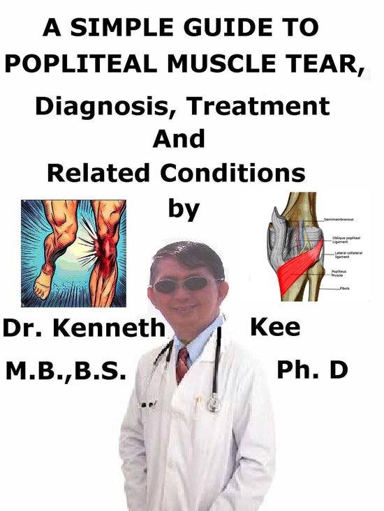 A Simple Guide to Popliteal Muscle Tear, Diagnosis, Treatment and