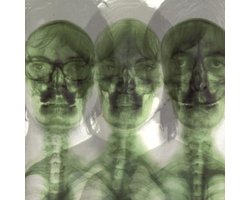 Supergrass