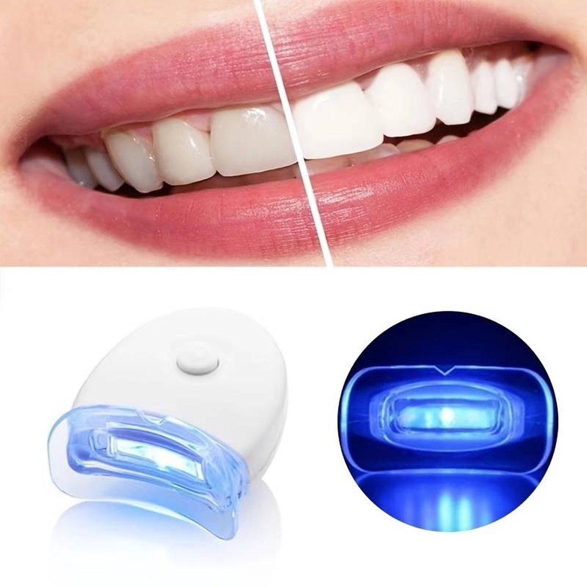 JED Tandenbleker - Led lamp - Snel en effectief - Wittere tanden - Mannen  en vrouwen - USB | bol