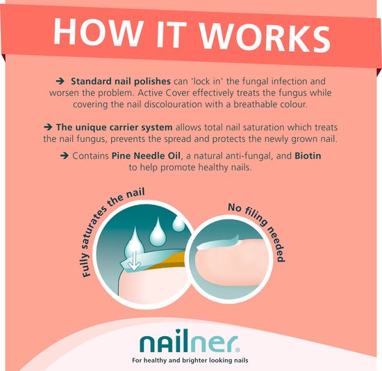 Nailner Active Cover Coral Red 2 in 1 - Kalknagelbehandeling voor Kalk en Schimmelnagel, Medische hulpmiddelen om Kalknagels te behandelen, Zuurstofdoorlatende Nagellak voor directe dekking van verkleuring, eenvoudig zonder te vijlen, 30 ml