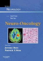 Neuro-Oncology E-Book