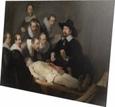 De anatomische les van Dr Nicolaes | Rembrandt van Rijn  | Plexiglas | Wanddecoratie | 120CM x 80CM | Schilderij | Oude meesters | Foto op plexiglas