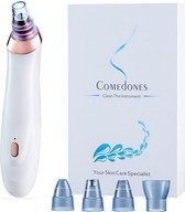 Blackhead Vacuüm Remover - White - Draadloos Onzuiverheden en Mee-eters verwijderen - Electrisch Puistjes en Acne Behandelen - Comedones Microdermabrasie - 3 Standen