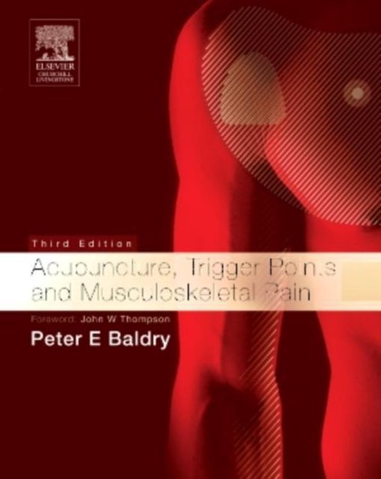 Acupuncture, Trigger Points and Musculoskeletal Pain 9780443066443