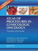 Bol Com Principles Of Gynecologic Oncology Surgery 9780323428781 Pedro T Ramirez Boeken