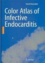 Color Atlas of Infective Endocarditis