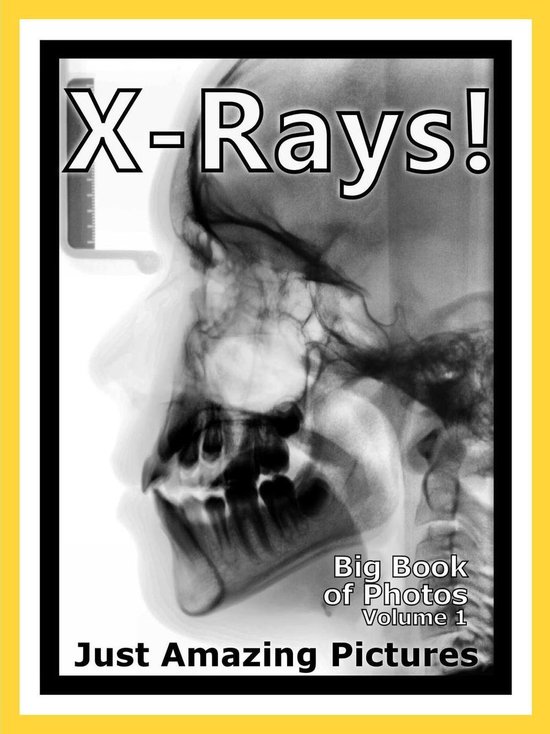 Just XRay Photos! Big Book of Photographs & Pictures of XRays