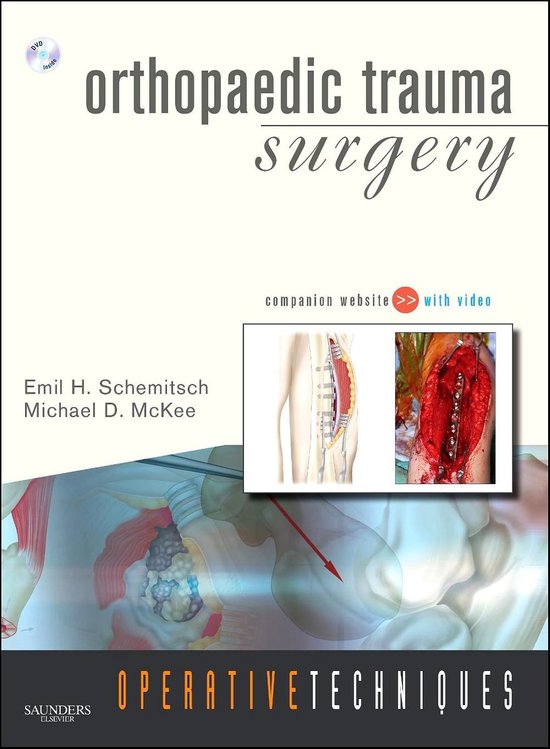 Operative Techniques: Orthopaedic Trauma Surgery