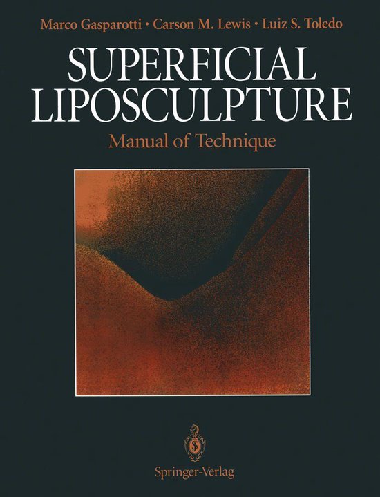 Superficial Liposculpture - cover