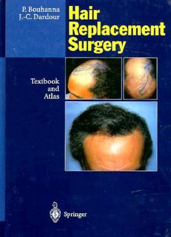 Hair Replacement Surgery - cover