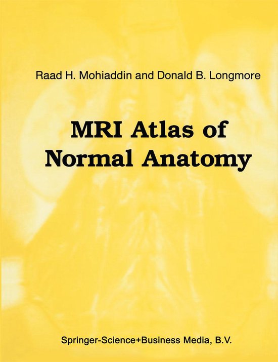 Series in Radiology 24 MRI Atlas of Normal Anatomy (ebook), R.H
