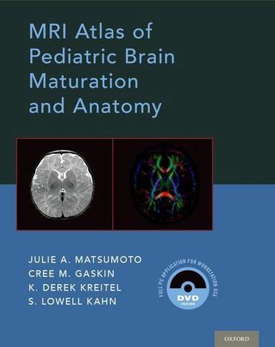 MRI Atlas of Pediatric Brain Maturation and Anatomy (ebook), Cree M