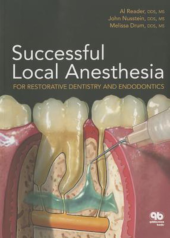 Successful Local Anesthesia For Restorative Dentistry and Endodontics
