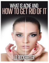 What is Acne and How to Get Rid of It