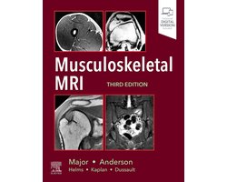 Musculoskeletal MRI