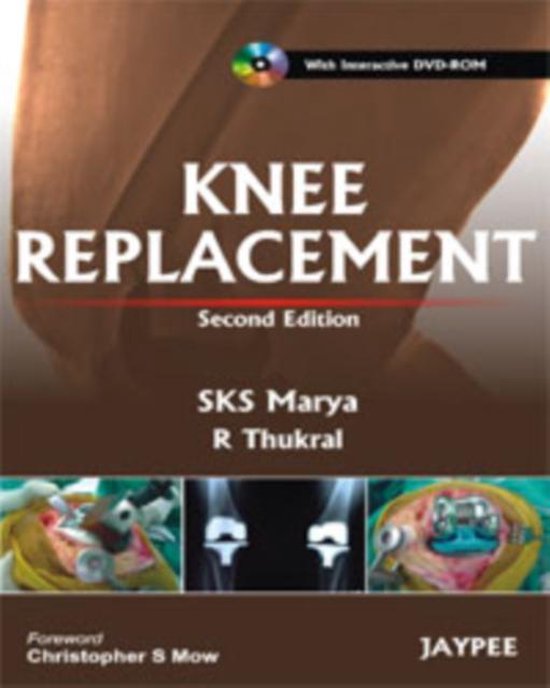 Knee Replacement [With DVD ROM] - cover