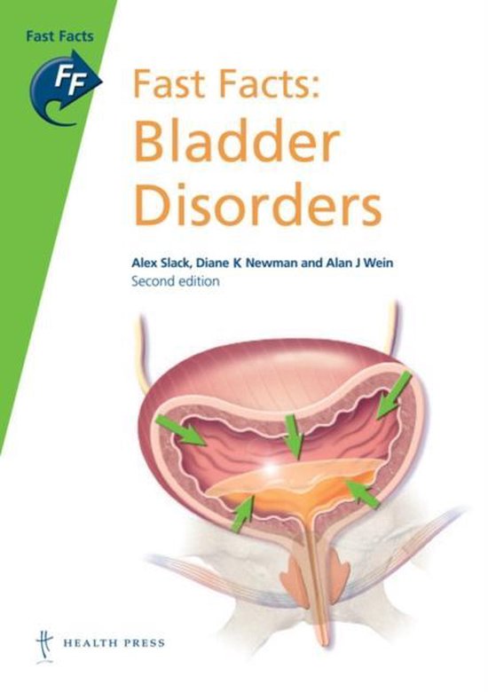 Fast Bladder Fast Facts Bladder Disorders | 9781905832965 | Alex Slack | Boeken ...