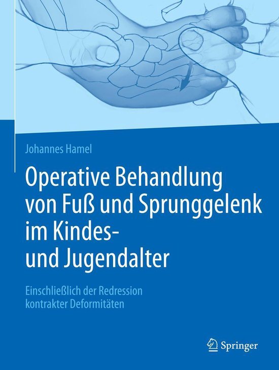 Operative Behandlung von Fuß und Sprunggelenk im Kindes- un ... - cover