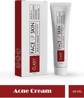 Clasy Care- face up skin - acne cream - puisten creme - BESTE ACNE CREME
