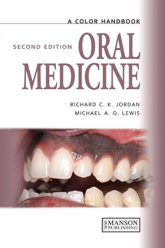 Oral Medicine, Second Edition - cover