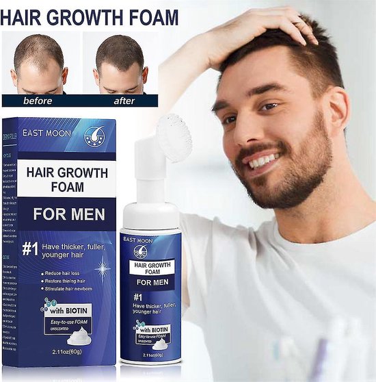 East Moon Haargroei Stimulator Foam - Minoxidil 5% Alternatief - Haargroei schuim - Haargroei versneller - Haargroeimiddel - Haaruitval Mannen - Haargroei producten vrouwen - Haargroei olie - Haargroei Mannen