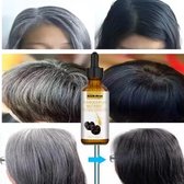 Ganoderma Nutrien - Antie grijzend haarserum - Natuurlijke kleurrherstel - Haarverzorging - Hoofdhuid voeden - Haar olie -