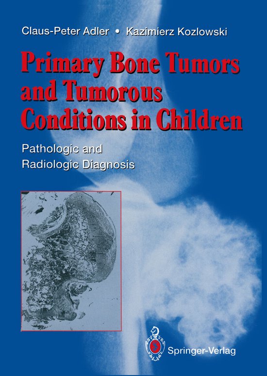Primary Bone Tumors and Tumorous Conditions in Children - cover